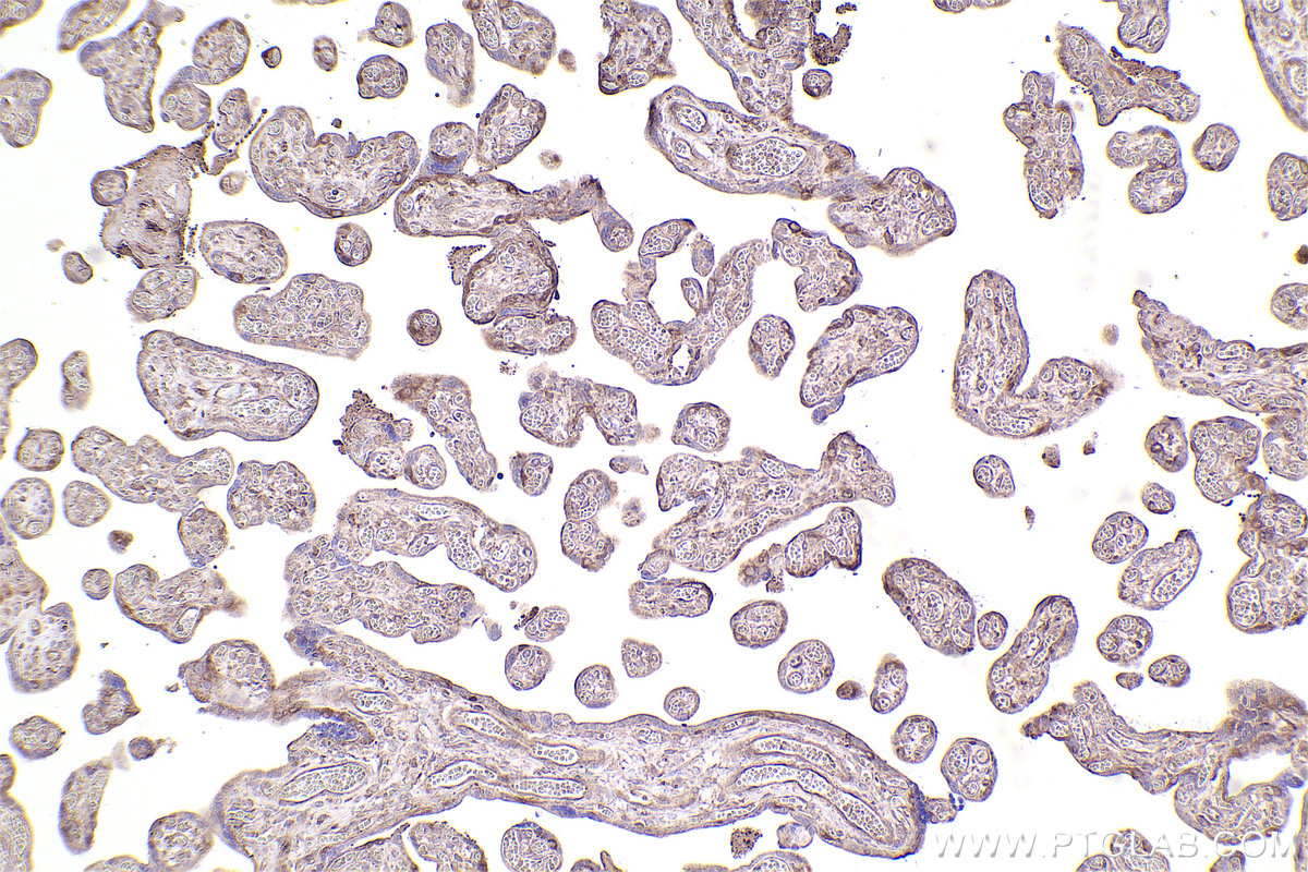 Immunohistochemical analysis of paraffin-embedded human placenta tissue slide using KHC2554 (UBR4 IHC Kit).