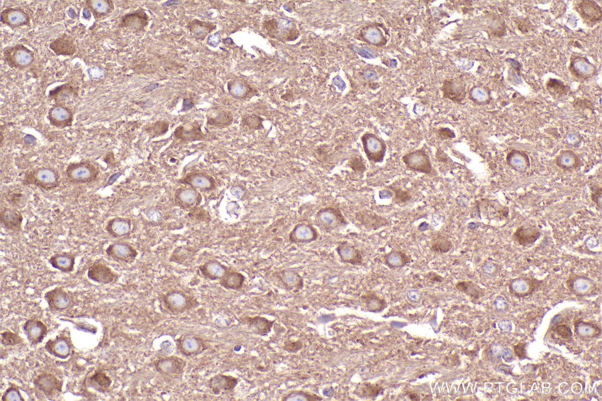 Immunohistochemical analysis of paraffin-embedded mouse brain tissue slide using KHC2554 (UBR4 IHC Kit).