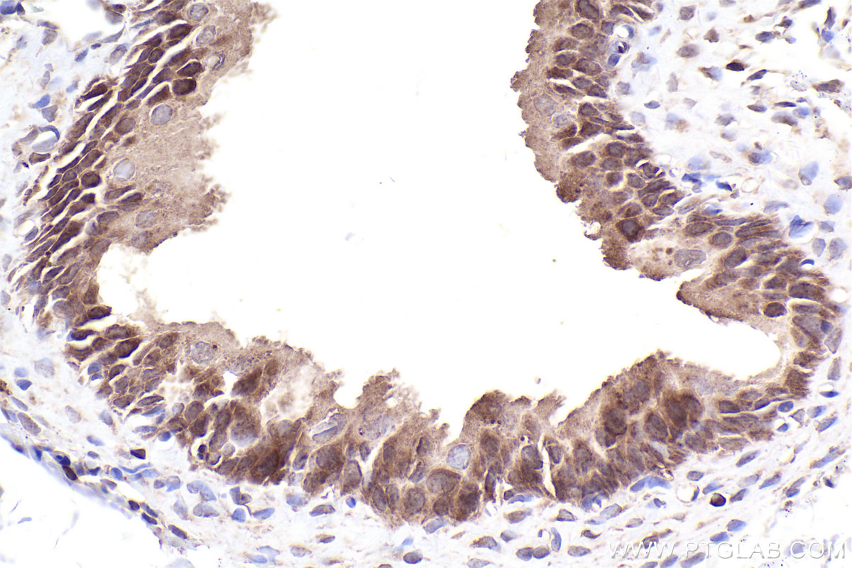 Immunohistochemical analysis of paraffin-embedded rat bladder tissue slide using KHC2554 (UBR4 IHC Kit).