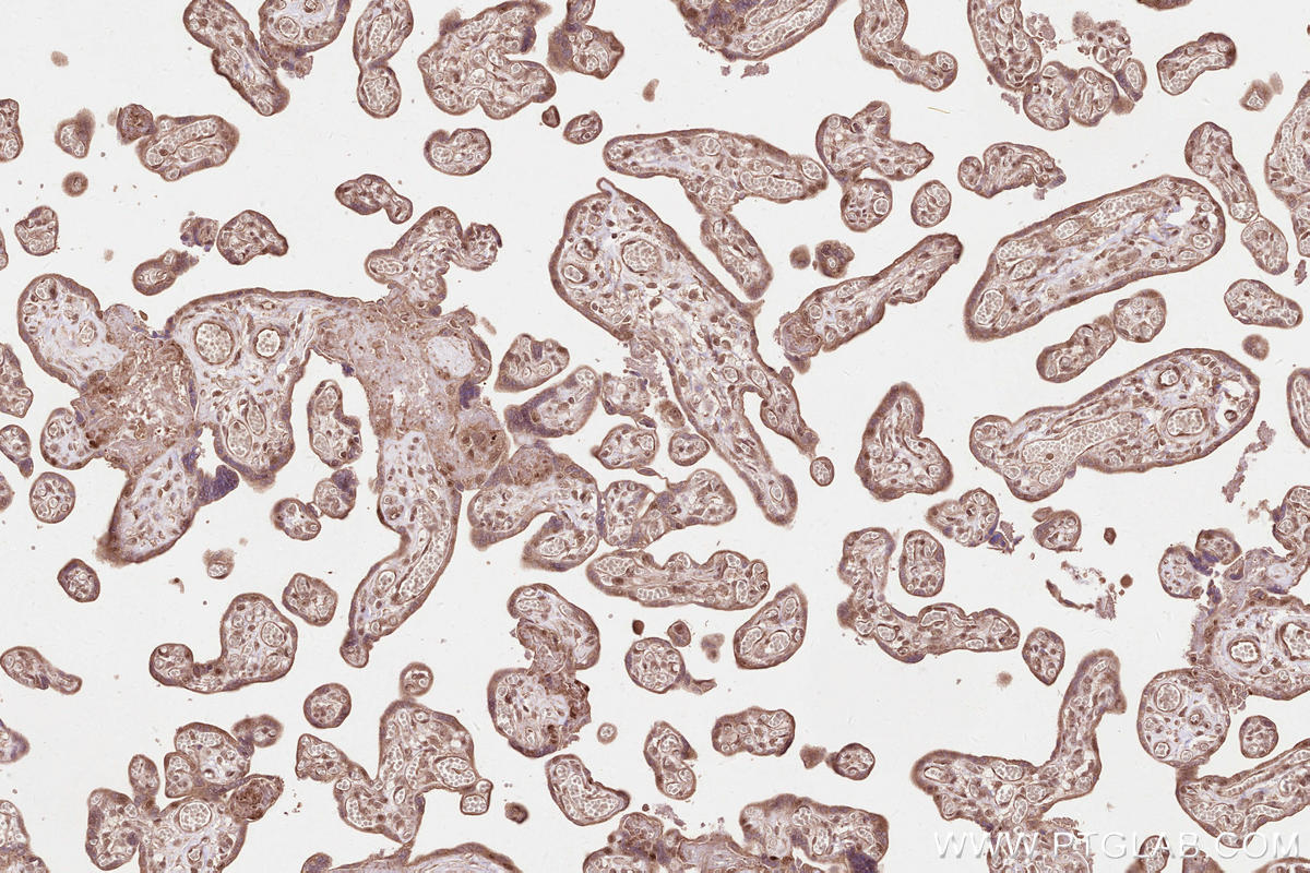 Immunohistochemical analysis of paraffin-embedded human placenta tissue slide using KHC2549 (UBXN11 IHC Kit).