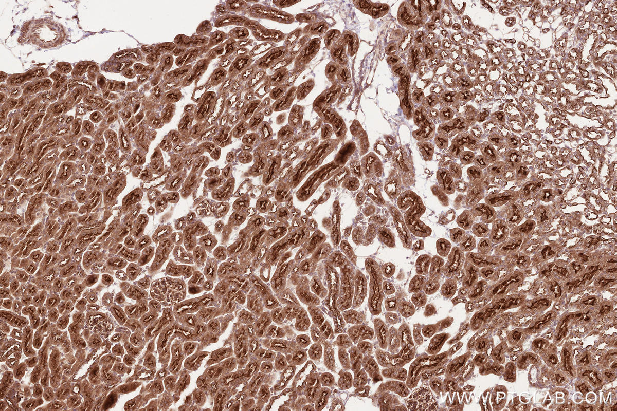 Immunohistochemical analysis of paraffin-embedded mouse kidney tissue slide using KHC2549 (UBXN11 IHC Kit).