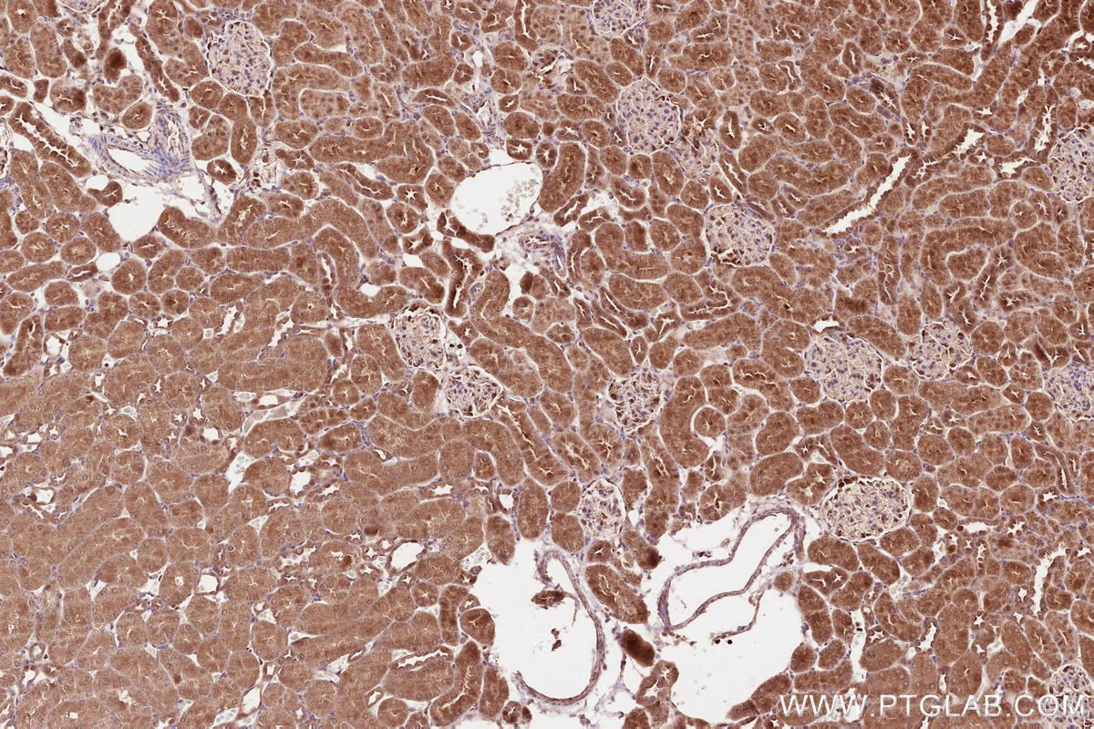 Immunohistochemical analysis of paraffin-embedded rat kidney tissue slide using KHC2549 (UBXN11 IHC Kit).