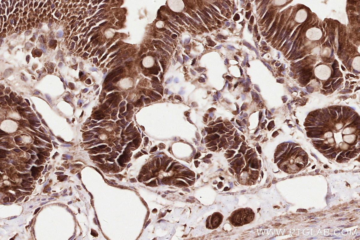 Immunohistochemical analysis of paraffin-embedded rat small intestine tissue slide using KHC2549 (UBXN11 IHC Kit).