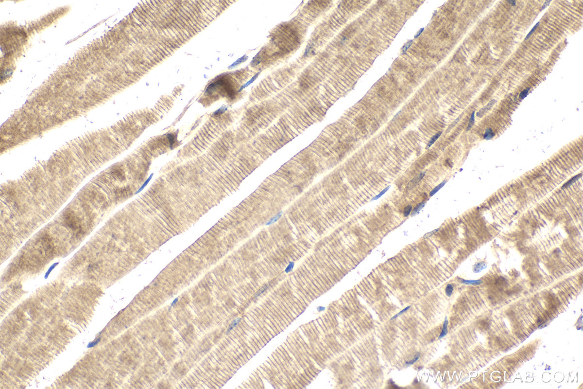 Immunohistochemical analysis of paraffin-embedded mouse skeletal muscle tissue slide using KHC2111 (ULK1 IHC Kit).