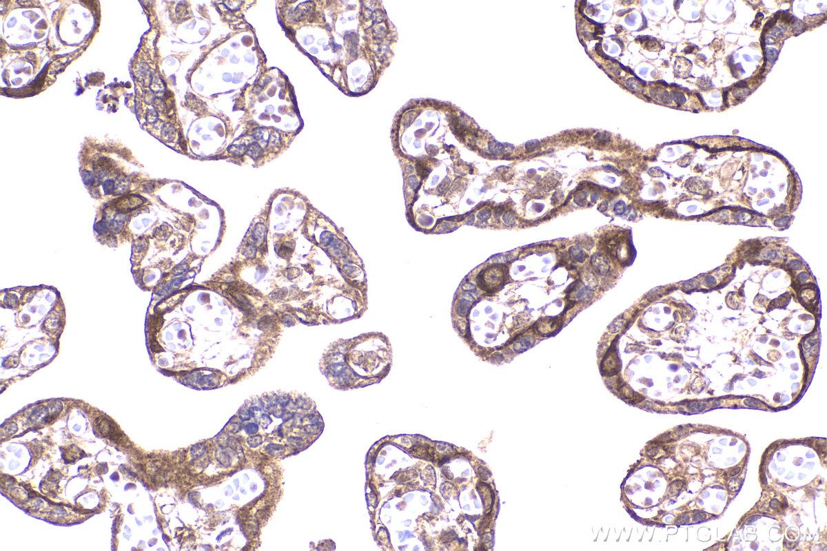 Immunohistochemical analysis of paraffin-embedded human placenta tissue slide using KHC2257 (USP8 IHC Kit).