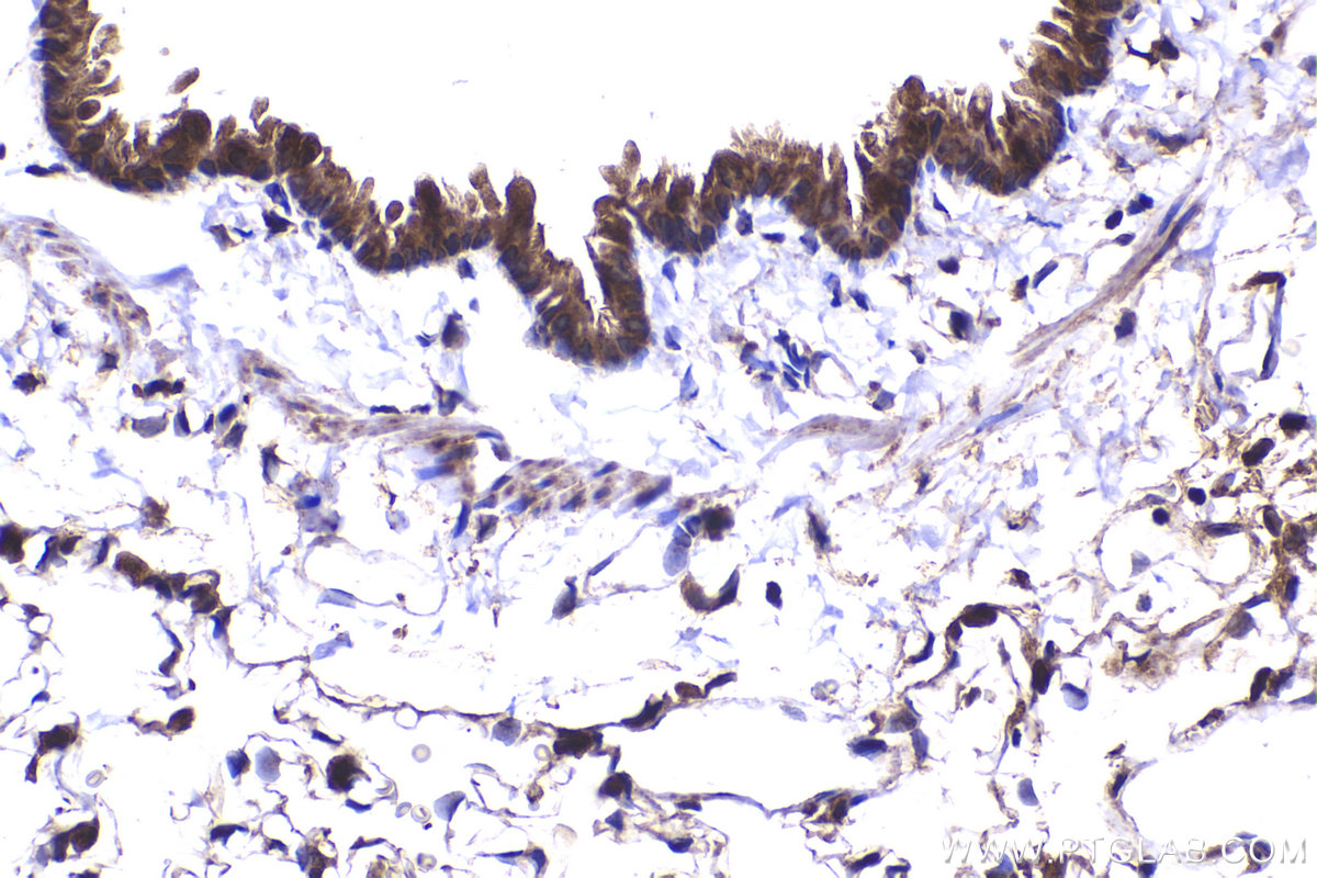 Immunohistochemical analysis of paraffin-embedded rat lung tissue slide using KHC2257 (USP8 IHC Kit).