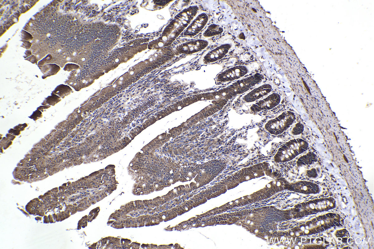 Immunohistochemical analysis of paraffin-embedded rat small intestine tissue slide using KHC2257 (USP8 IHC Kit).