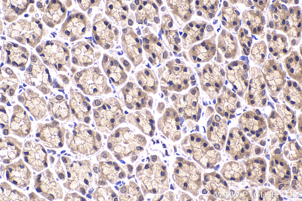 Immunohistochemical analysis of paraffin-embedded rat stomach tissue slide using KHC2257 (USP8 IHC Kit).