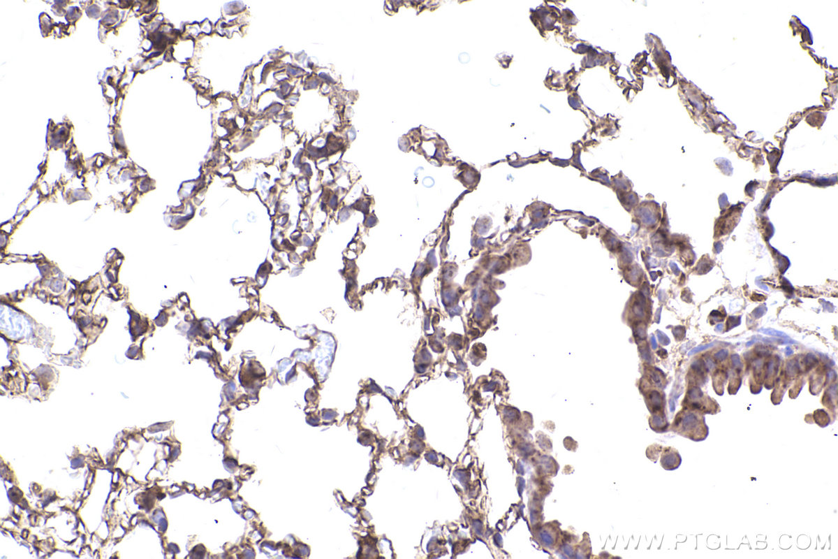 Immunohistochemical analysis of paraffin-embedded mouse lung tissue slide using KHC2500 (VAMP3/Cellubrevin IHC Kit).