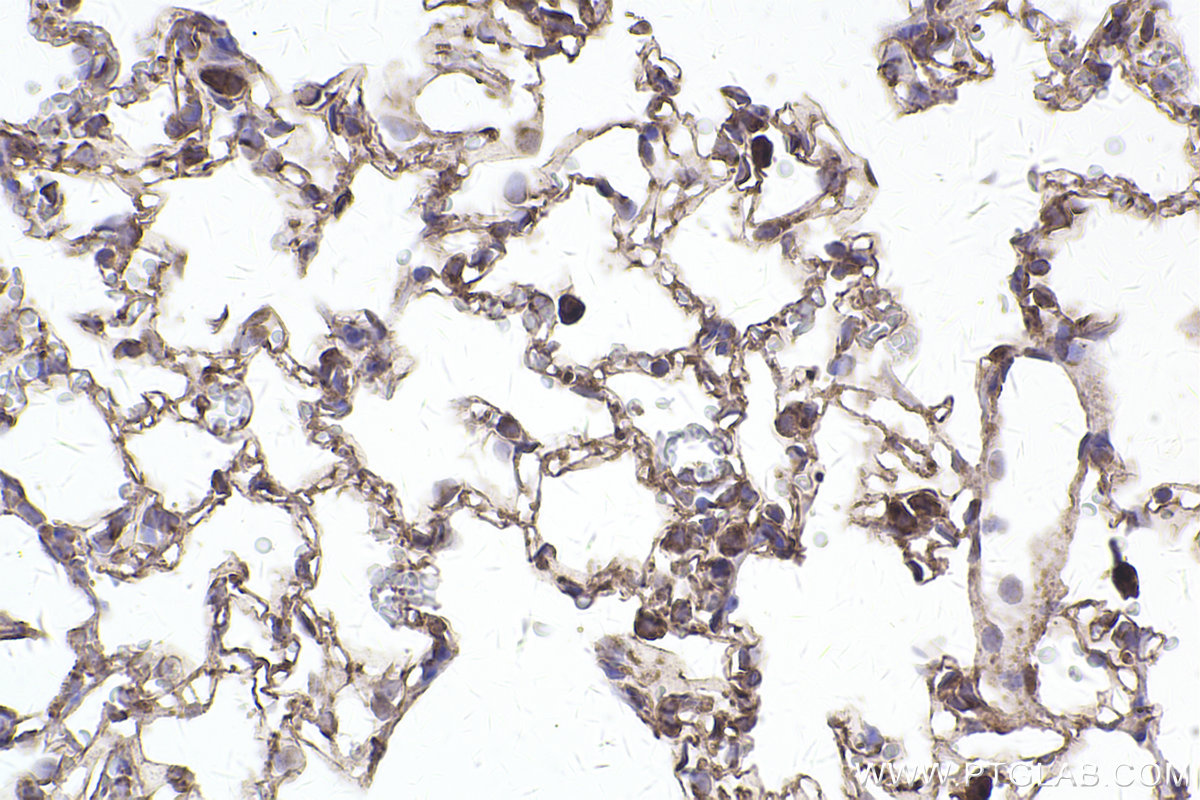 Immunohistochemical analysis of paraffin-embedded rat lung tissue slide using KHC2500 (VAMP3/Cellubrevin IHC Kit).