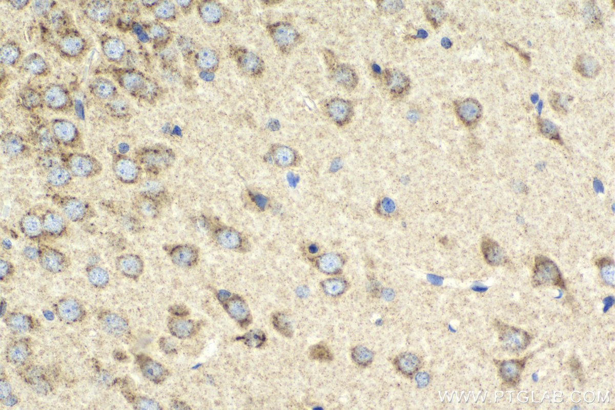Immunohistochemical analysis of paraffin-embedded rat brain tissue slide using KHC2110 (VAMP4 IHC Kit).