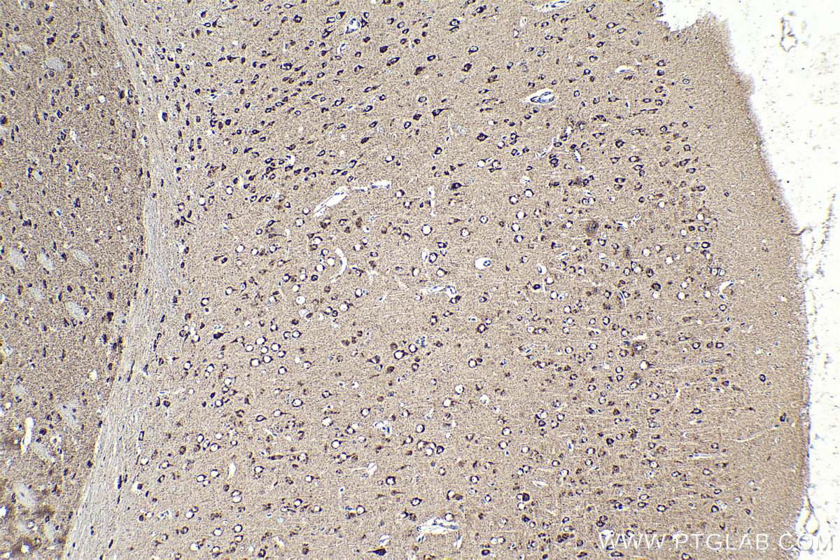 Immunohistochemical analysis of paraffin-embedded mouse brain tissue slide using KHC2110 (VAMP4 IHC Kit).