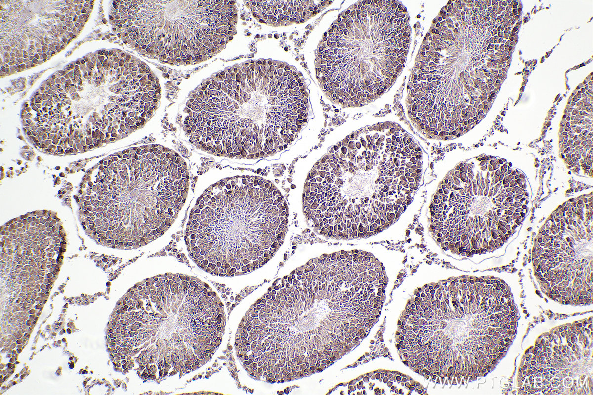 Immunohistochemical analysis of paraffin-embedded rat testis tissue slide using KHC2312 (VAV2 IHC Kit).