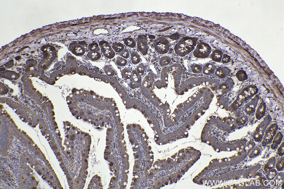 Immunohistochemical analysis of paraffin-embedded rat small intestine tissue slide using KHC2265 (VDAC2 IHC Kit).