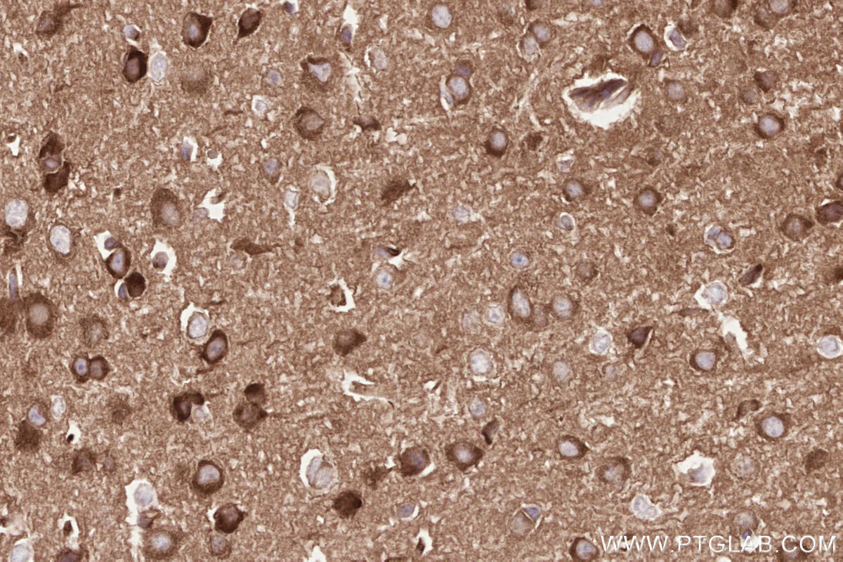 Immunohistochemical analysis of paraffin-embedded mouse brain tissue slide using KHC2560 (VPS53 IHC Kit).