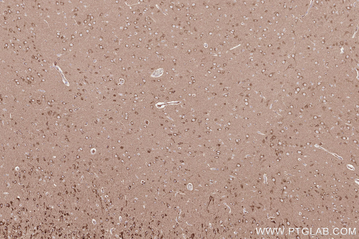 Immunohistochemical analysis of paraffin-embedded rat brain tissue slide using KHC2560 (VPS53 IHC Kit).