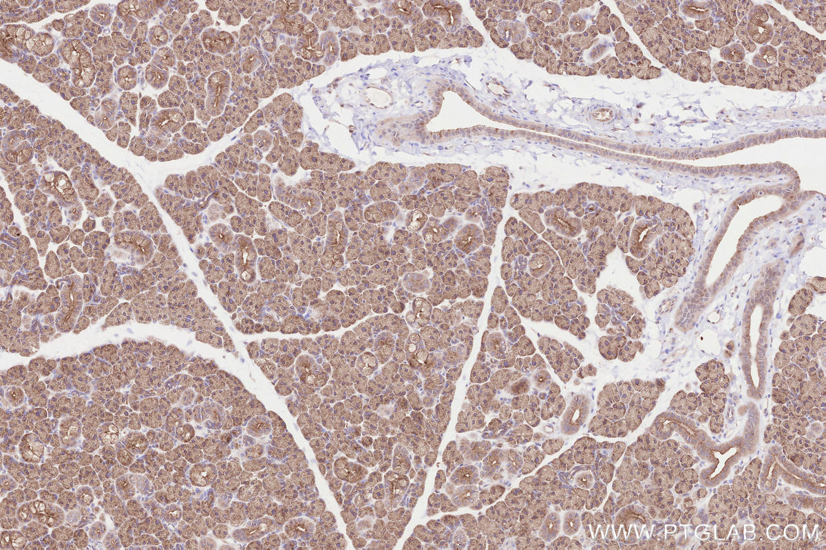 Immunohistochemical analysis of paraffin-embedded rat salivary gland tissue slide using KHC2560 (VPS53 IHC Kit).