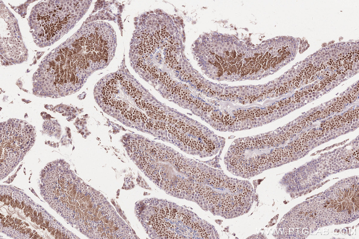 Immunohistochemical analysis of paraffin-embedded mouse testis tissue slide using KHC2578 (WBP2NL IHC Kit).