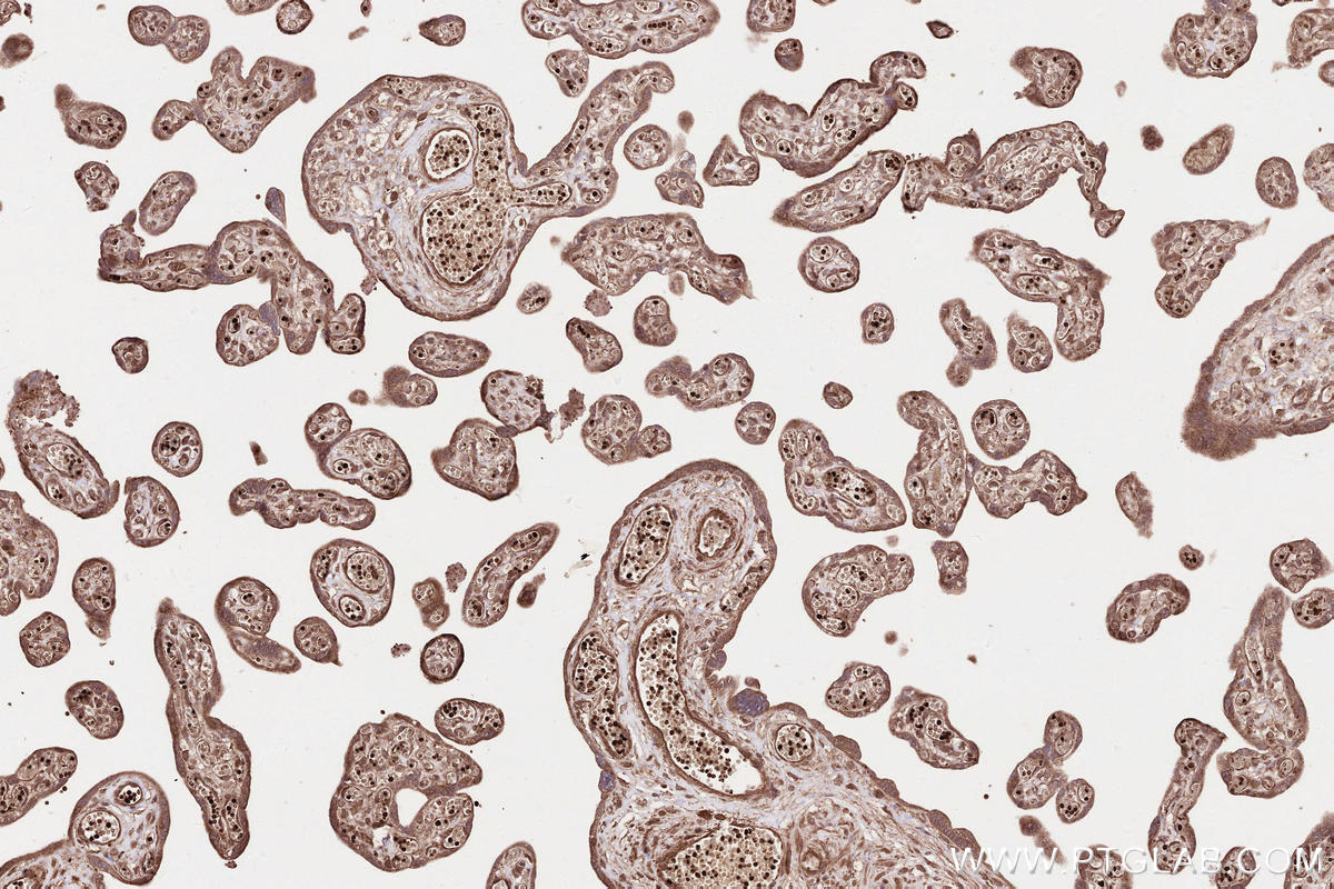 Immunohistochemical analysis of paraffin-embedded human placenta tissue slide using KHC2537 (WDR81 IHC Kit).