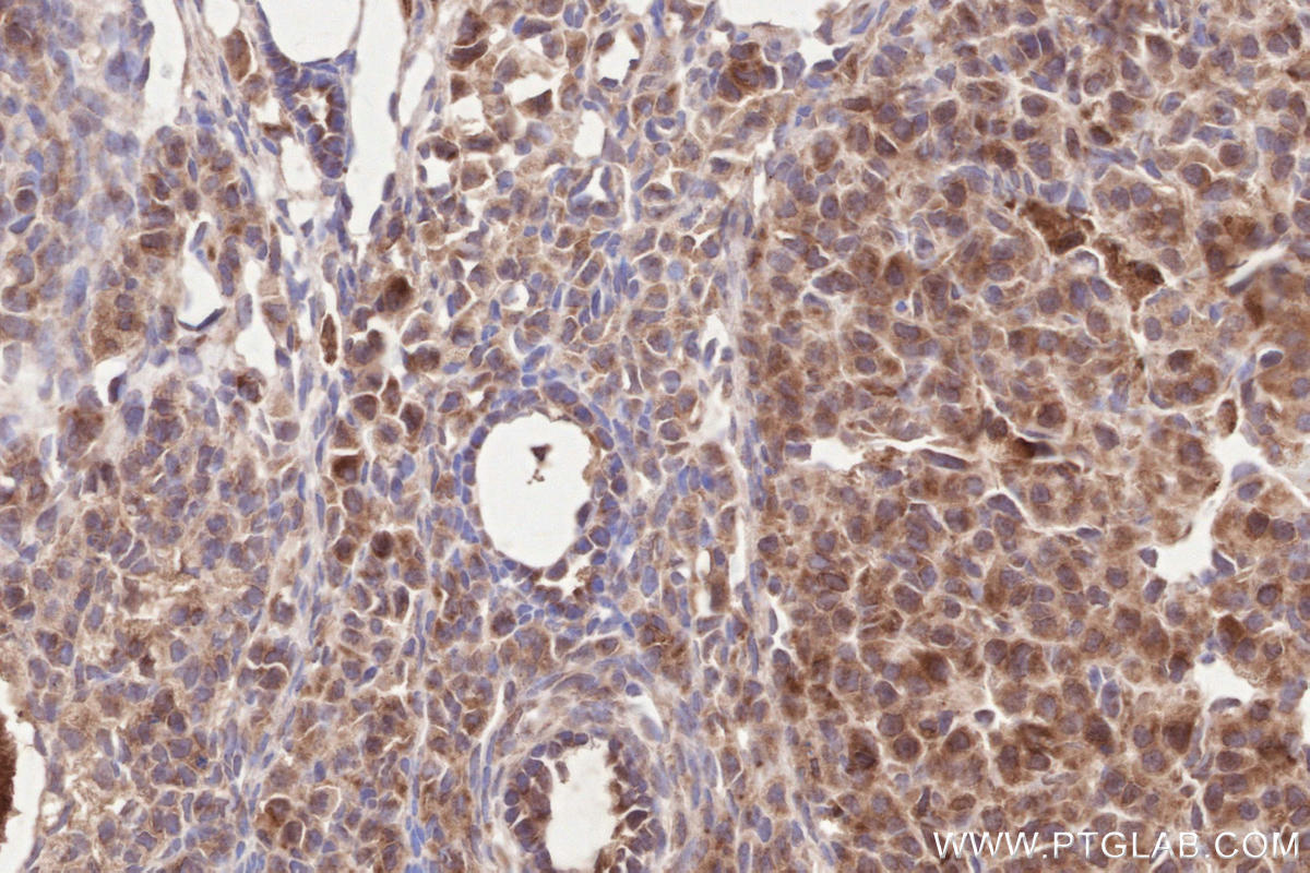 Immunohistochemical analysis of paraffin-embedded mouse ovary tissue slide using KHC2537 (WDR81 IHC Kit).