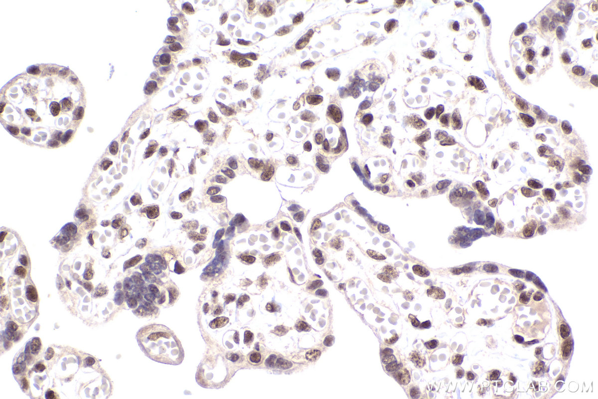 Immunohistochemical analysis of paraffin-embedded human placenta tissue slide using KHC2210 (XPA IHC Kit).