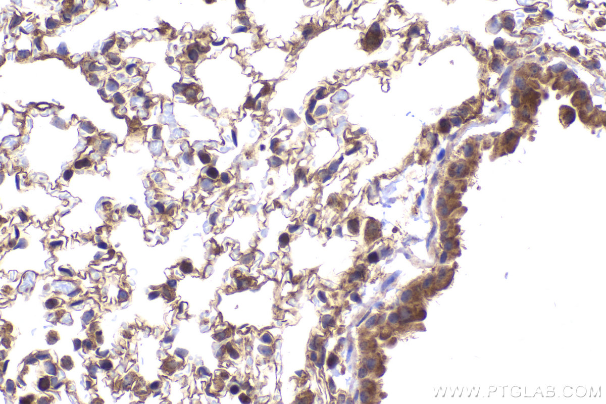 Immunohistochemical analysis of paraffin-embedded mouse lung tissue slide using KHC2166 (YES1 IHC Kit).