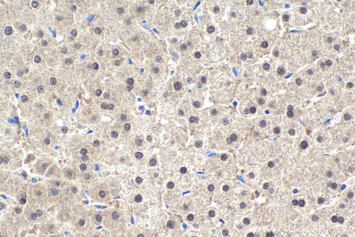 Immunohistochemical analysis of paraffin-embedded human liver tissue slide using KHC1944 (ZBTB20 IHC Kit).