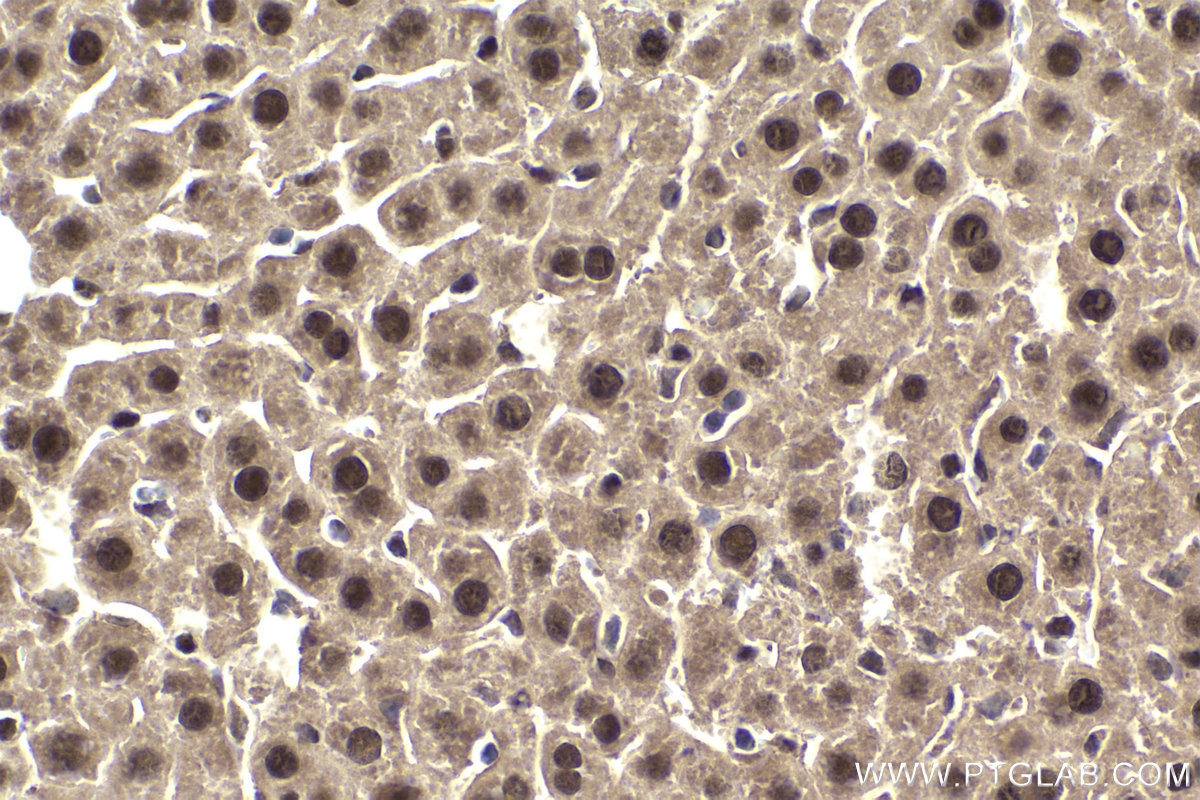 Immunohistochemical analysis of paraffin-embedded mouse liver tissue slide using KHC1944 (ZBTB20 IHC Kit).