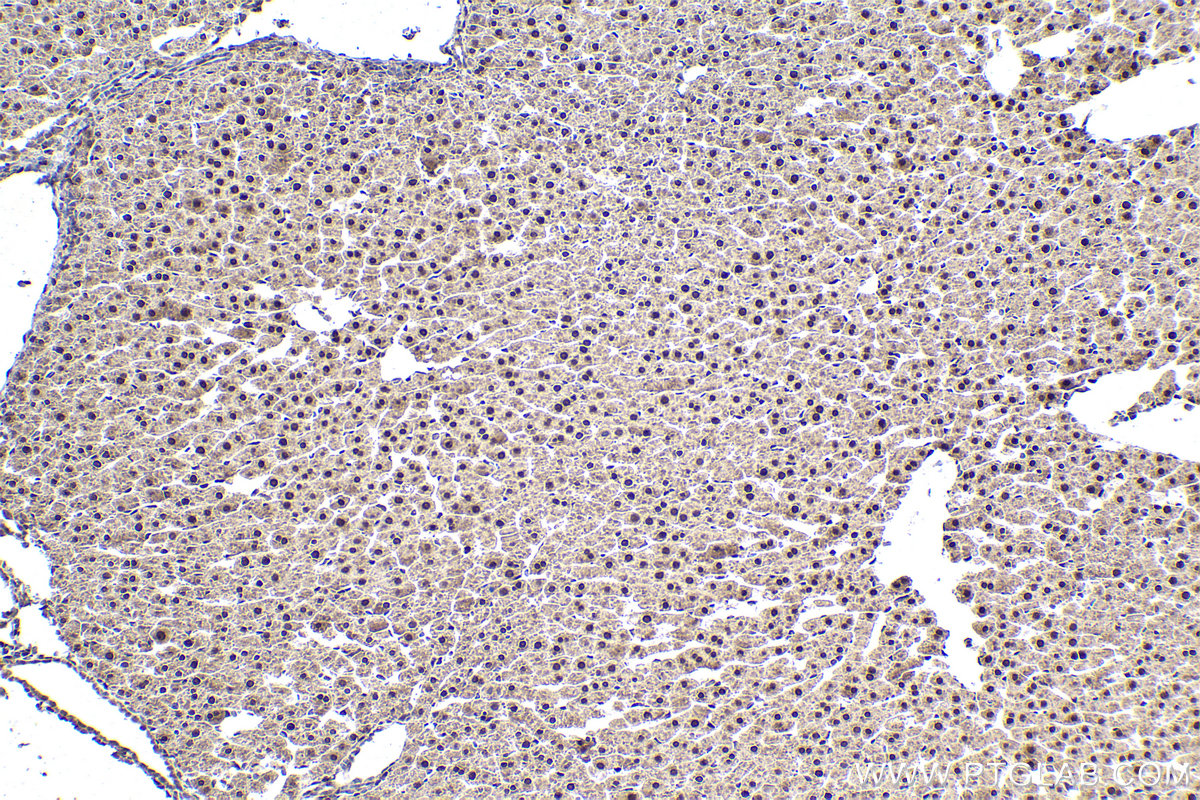Immunohistochemical analysis of paraffin-embedded rat liver tissue slide using KHC1944 (ZBTB20 IHC Kit).