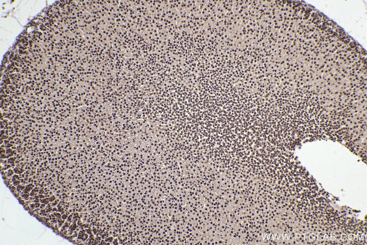 Immunohistochemical analysis of paraffin-embedded mouse adrenal gland tissue slide using KHC2550 (ZC3H13 IHC Kit).