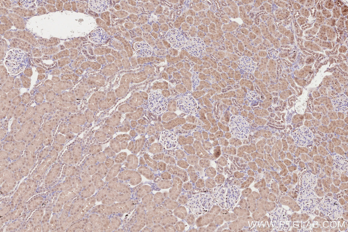 Immunohistochemical analysis of paraffin-embedded rat kidney tissue slide using KHC2618 (ZC3HAV1 IHC Kit).