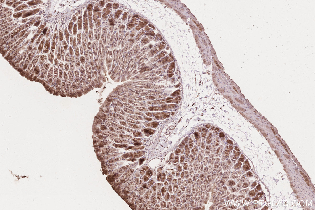 Immunohistochemical analysis of paraffin-embedded mouse stomach tissue slide using KHC2618 (ZC3HAV1 IHC Kit).