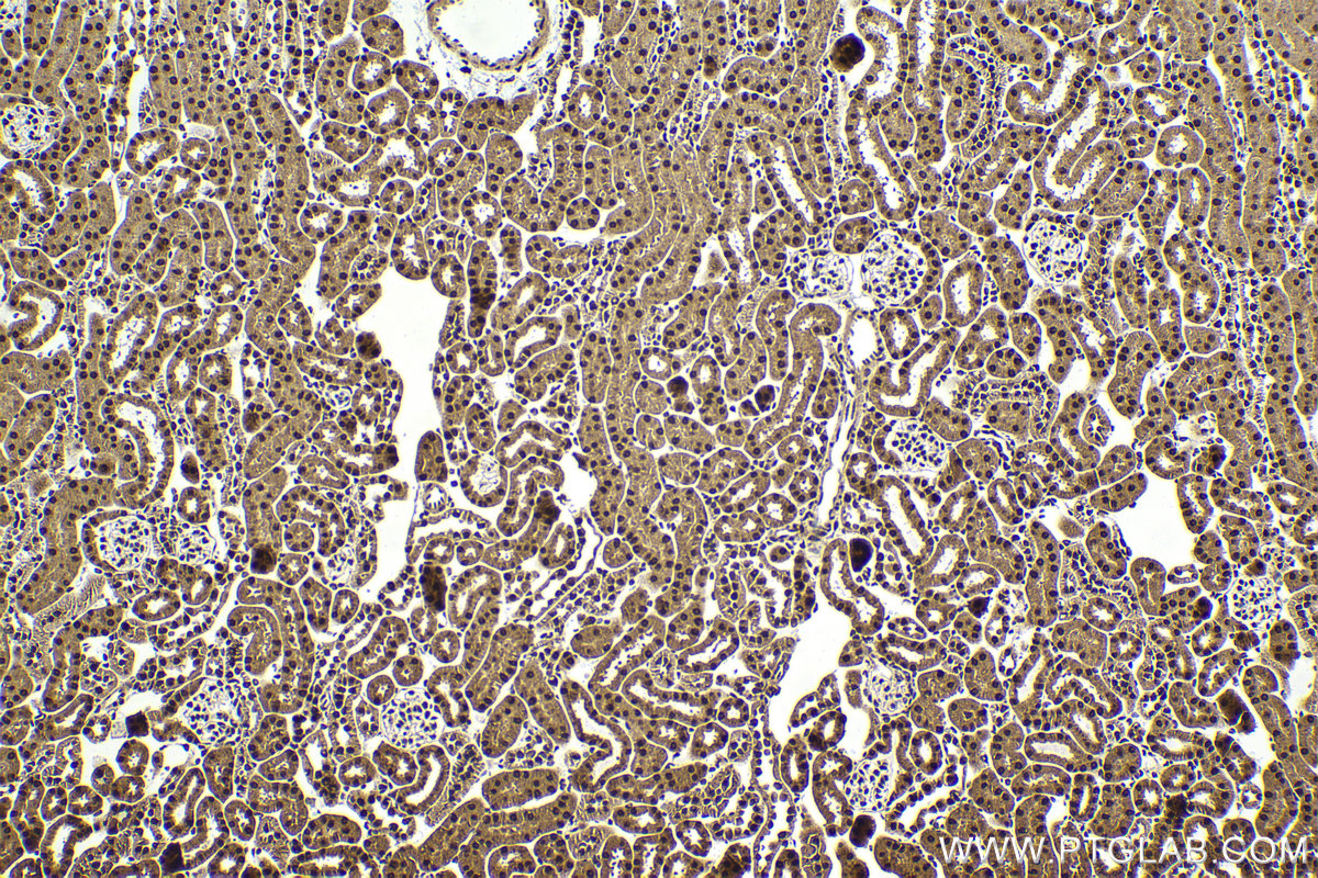 Immunohistochemical analysis of paraffin-embedded mouse kidney tissue slide using KHC1997 (ZMIZ1 IHC Kit).