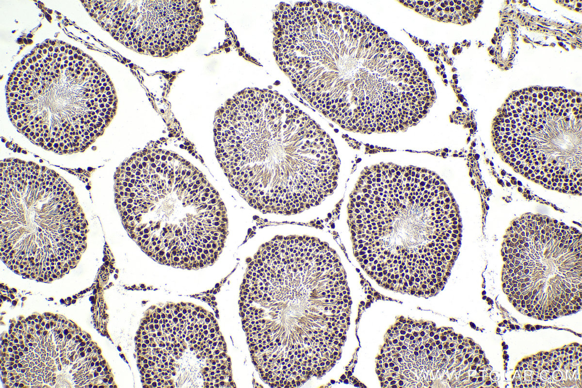 Immunohistochemical analysis of paraffin-embedded rat testis tissue slide using KHC1997 (ZMIZ1 IHC Kit).