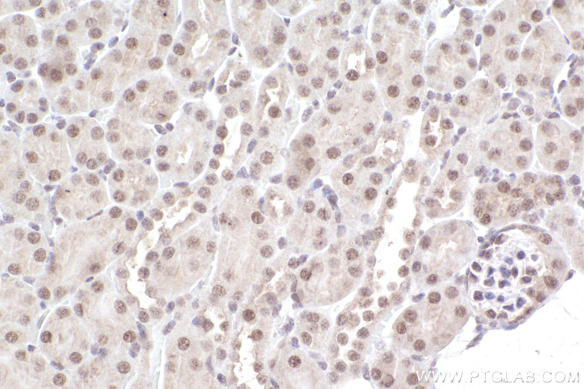 Immunohistochemical analysis of paraffin-embedded mouse kidney tissue slide using KHC2542 (ZNF326 IHC Kit).