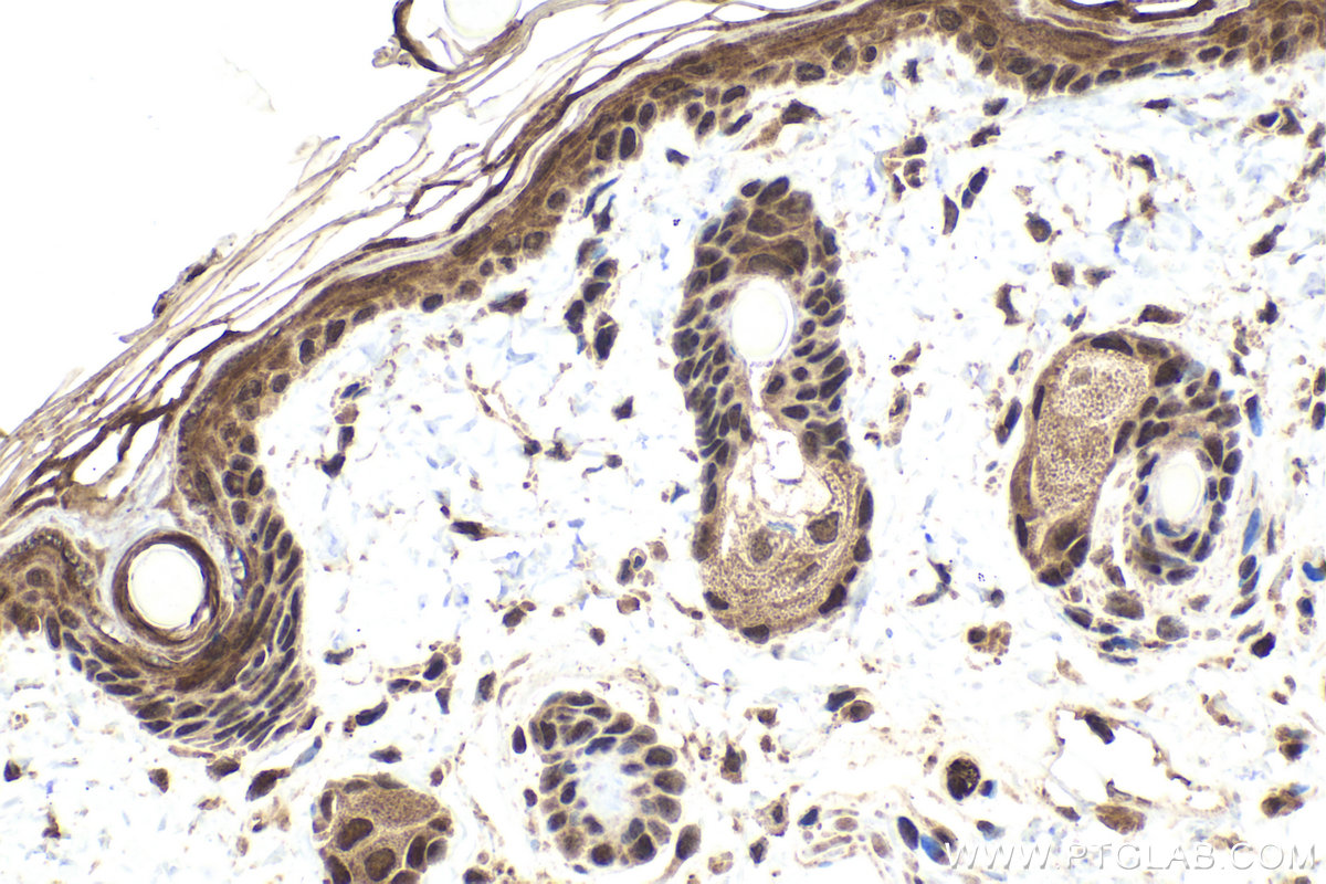 Immunohistochemical analysis of paraffin-embedded rat skin tissue slide using KHC1937 (ZNF703 IHC Kit).