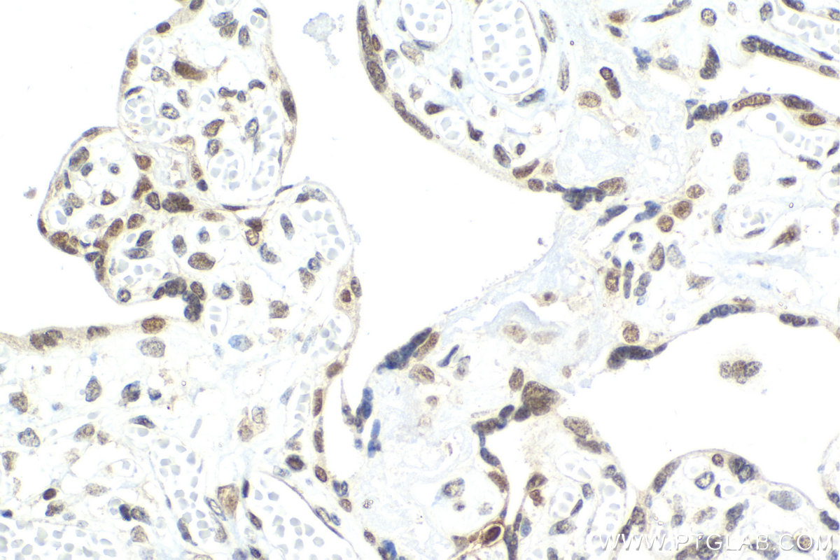 Immunohistochemical analysis of paraffin-embedded human placenta tissue slide using KHC2077 (ZNHIT1 IHC Kit).