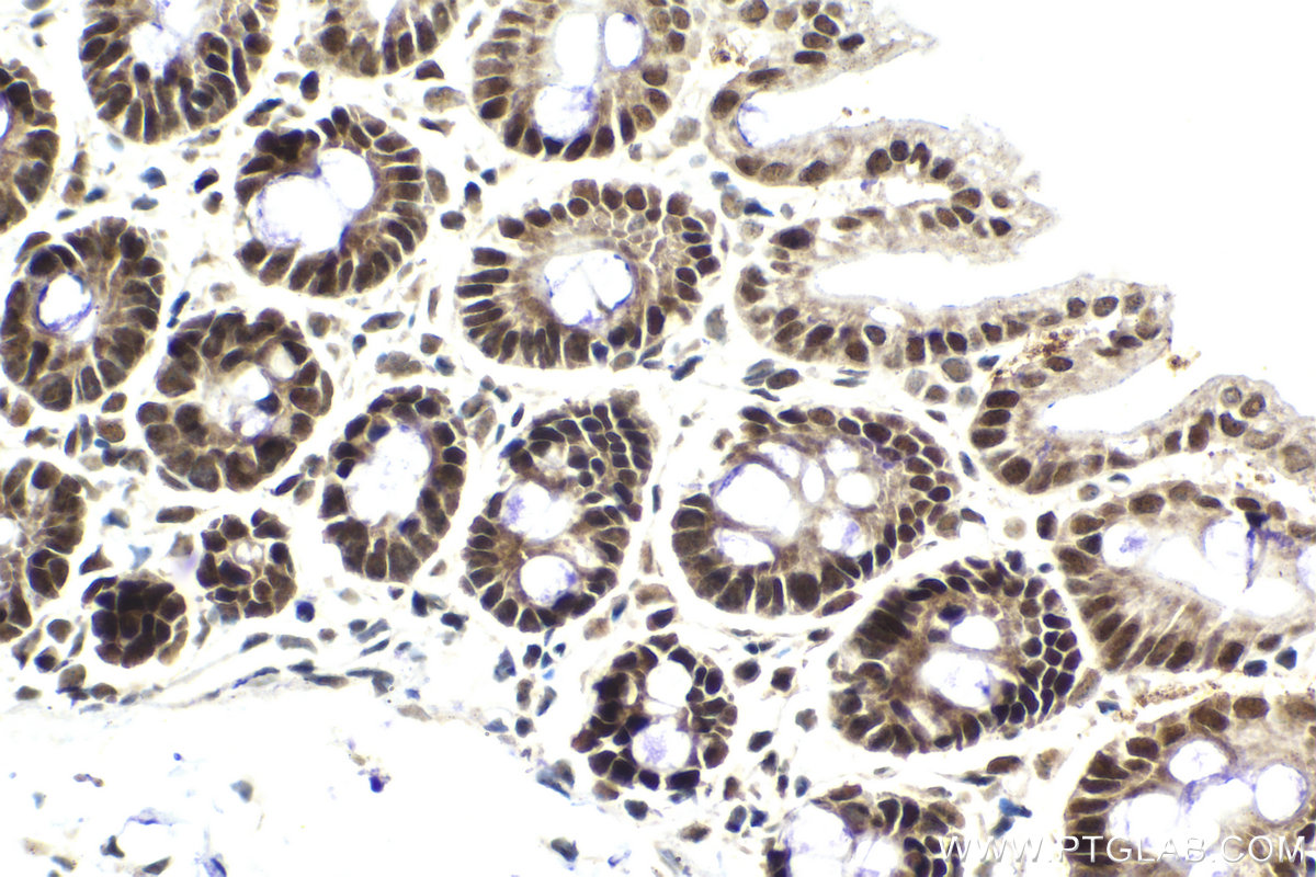 Immunohistochemical analysis of paraffin-embedded mouse small intestine tissue slide using KHC2077 (ZNHIT1 IHC Kit).