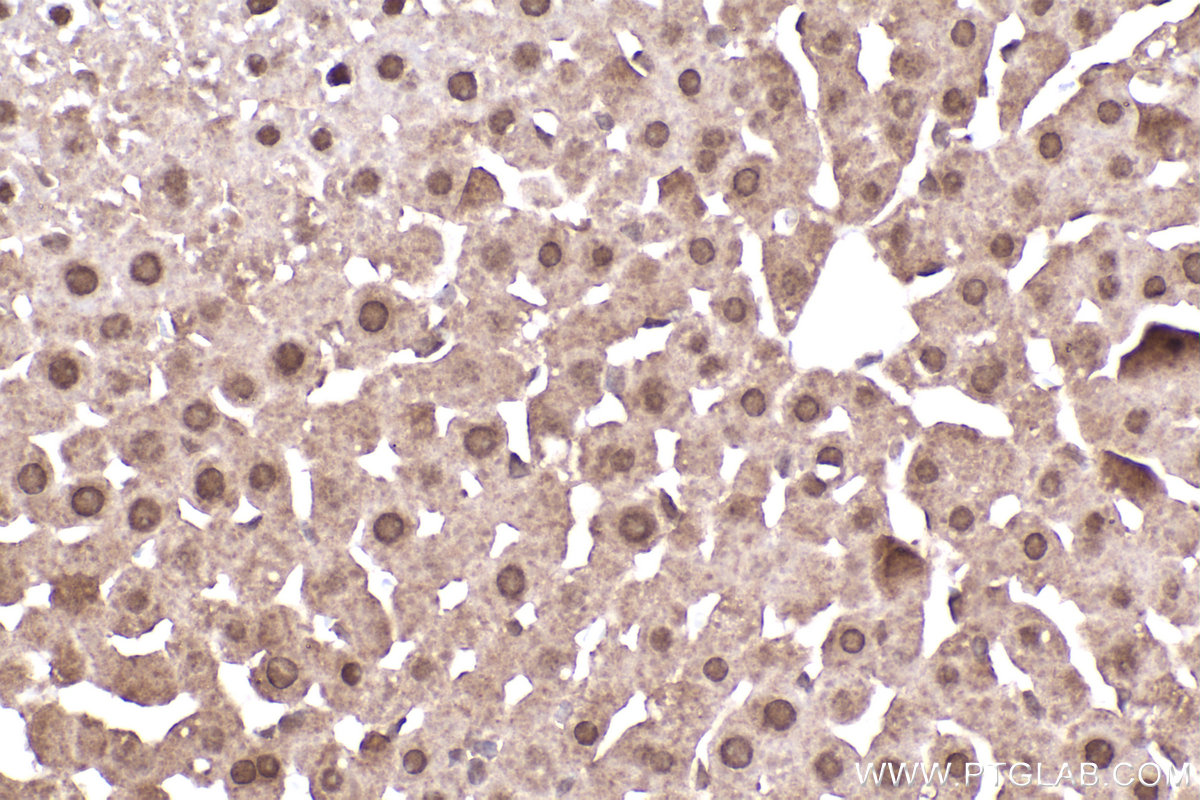 Immunohistochemical analysis of paraffin-embedded rat liver tissue slide using KHC2211 (RPS6KB1 IHC Kit).