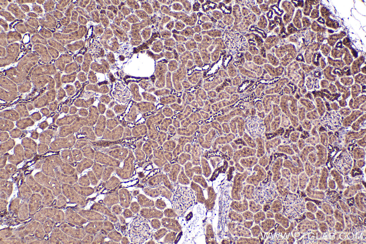 Immunohistochemical analysis of paraffin-embedded rat kidney tissue slide using KHC2211 (RPS6KB1 IHC Kit).