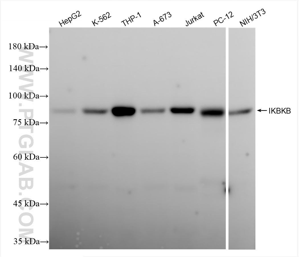 Western Blot (WB) analysis of various lysates using IKKB Recombinant antibody (81347-2-RR)