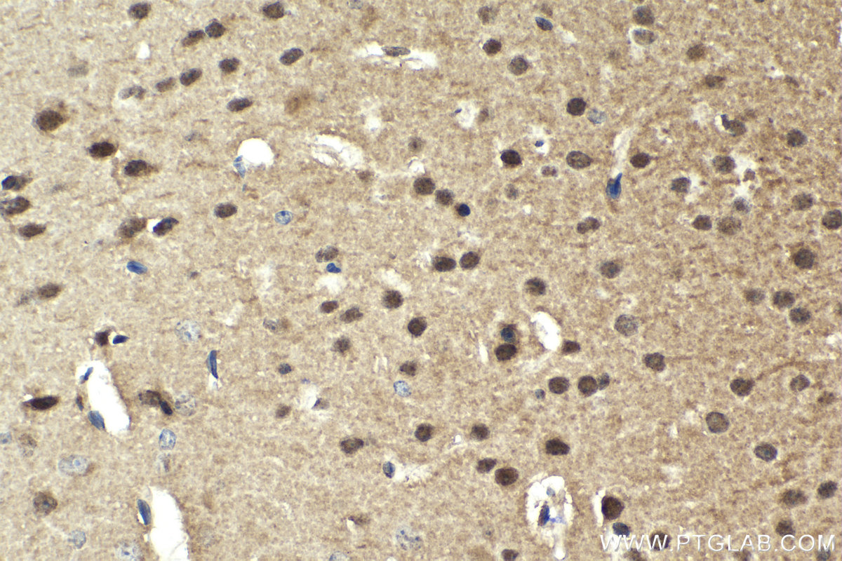 Immunohistochemistry (IHC) staining of mouse brain tissue using IKBKG Polyclonal antibody (18474-1-AP)