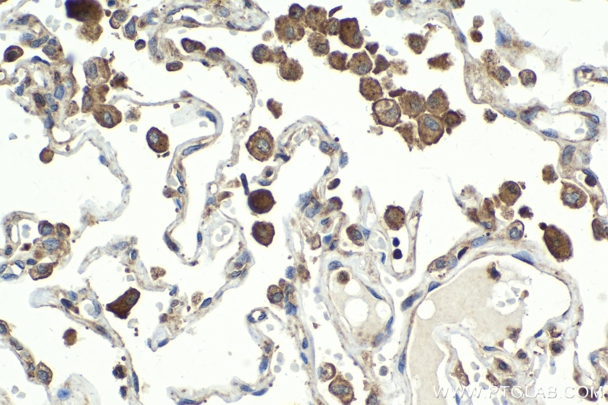 Immunohistochemistry (IHC) staining of human lung tissue using IKBKG Polyclonal antibody (18474-1-AP)