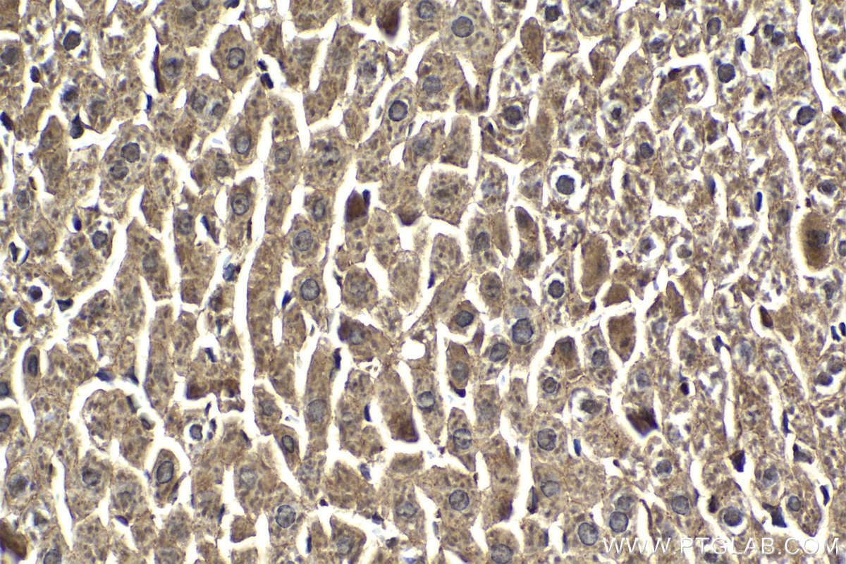 Immunohistochemistry (IHC) staining of rat liver tissue using IKBKG Polyclonal antibody (18474-1-AP)