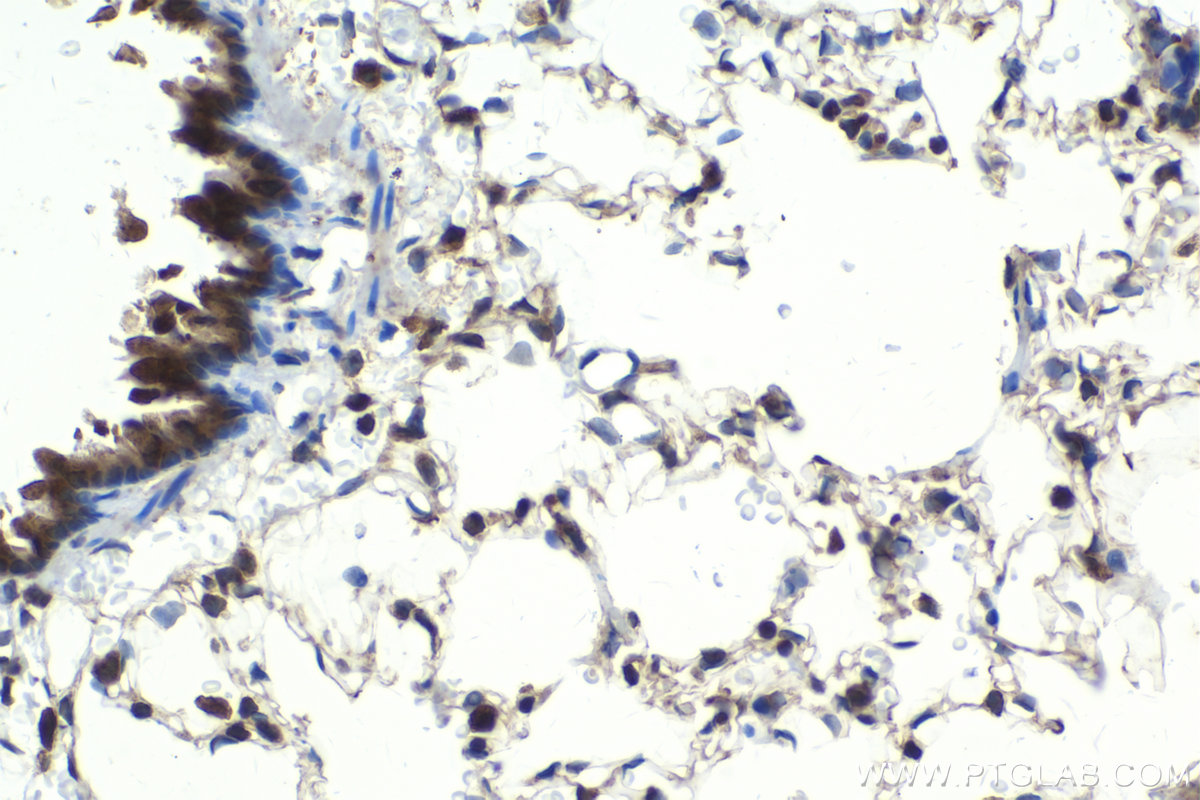 Immunohistochemistry (IHC) staining of rat lung tissue using IKBKG Polyclonal antibody (18474-1-AP)