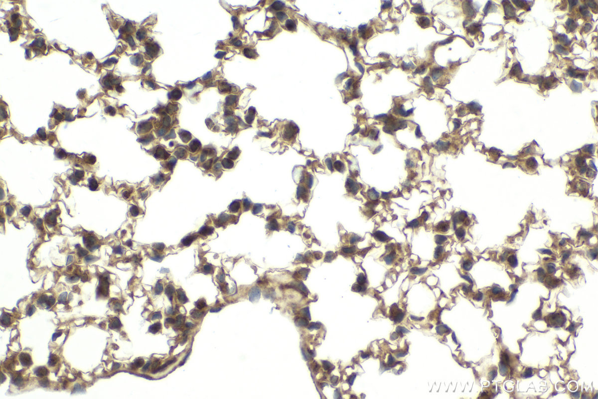 Immunohistochemistry (IHC) staining of mouse lung tissue using IKBKG Polyclonal antibody (18474-1-AP)