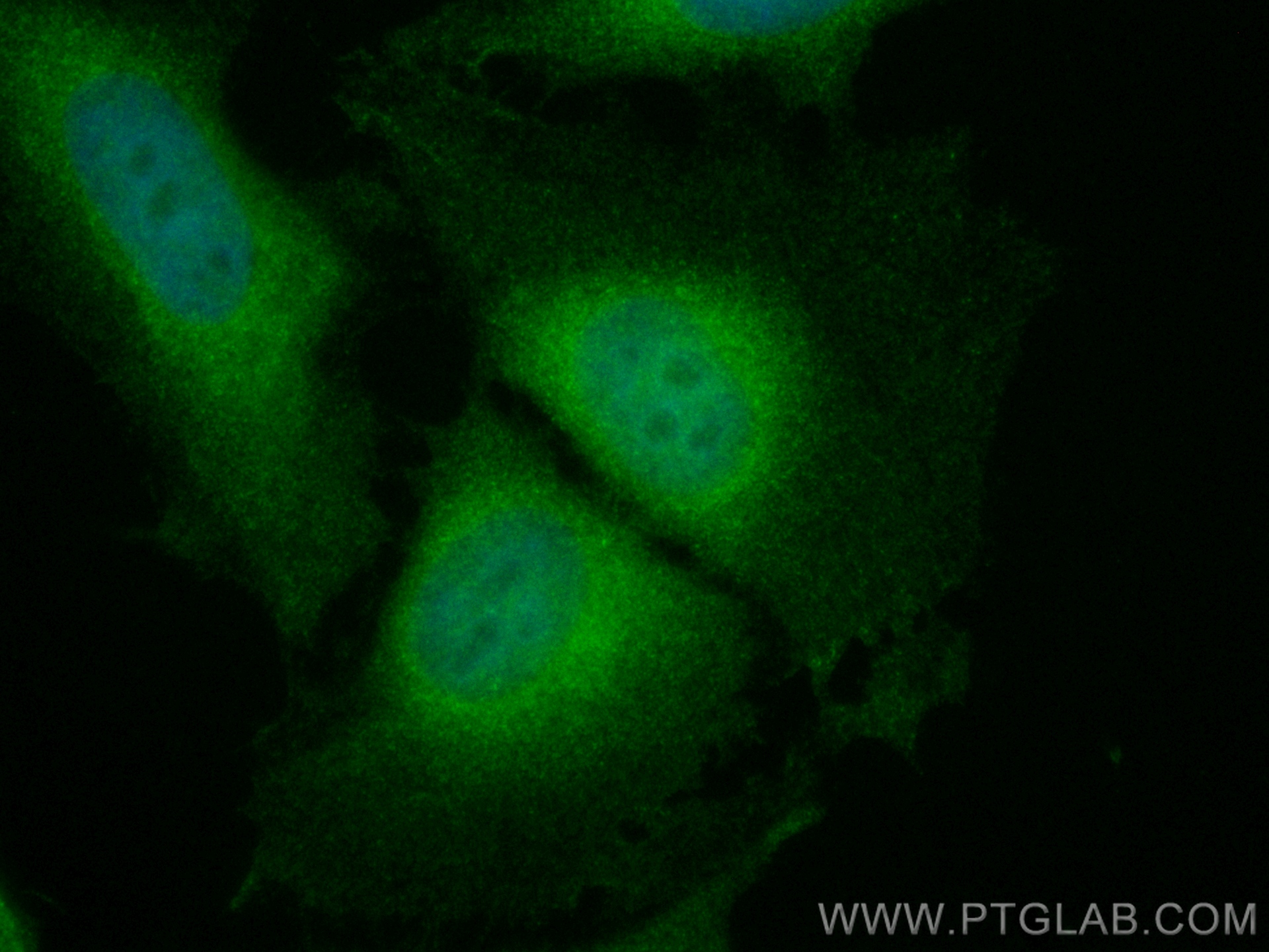 Immunofluorescence (IF) / fluorescent staining of HeLa cells using CoraLite® Plus 488-conjugated IKBKG Monoclonal ant (CL488-66460)