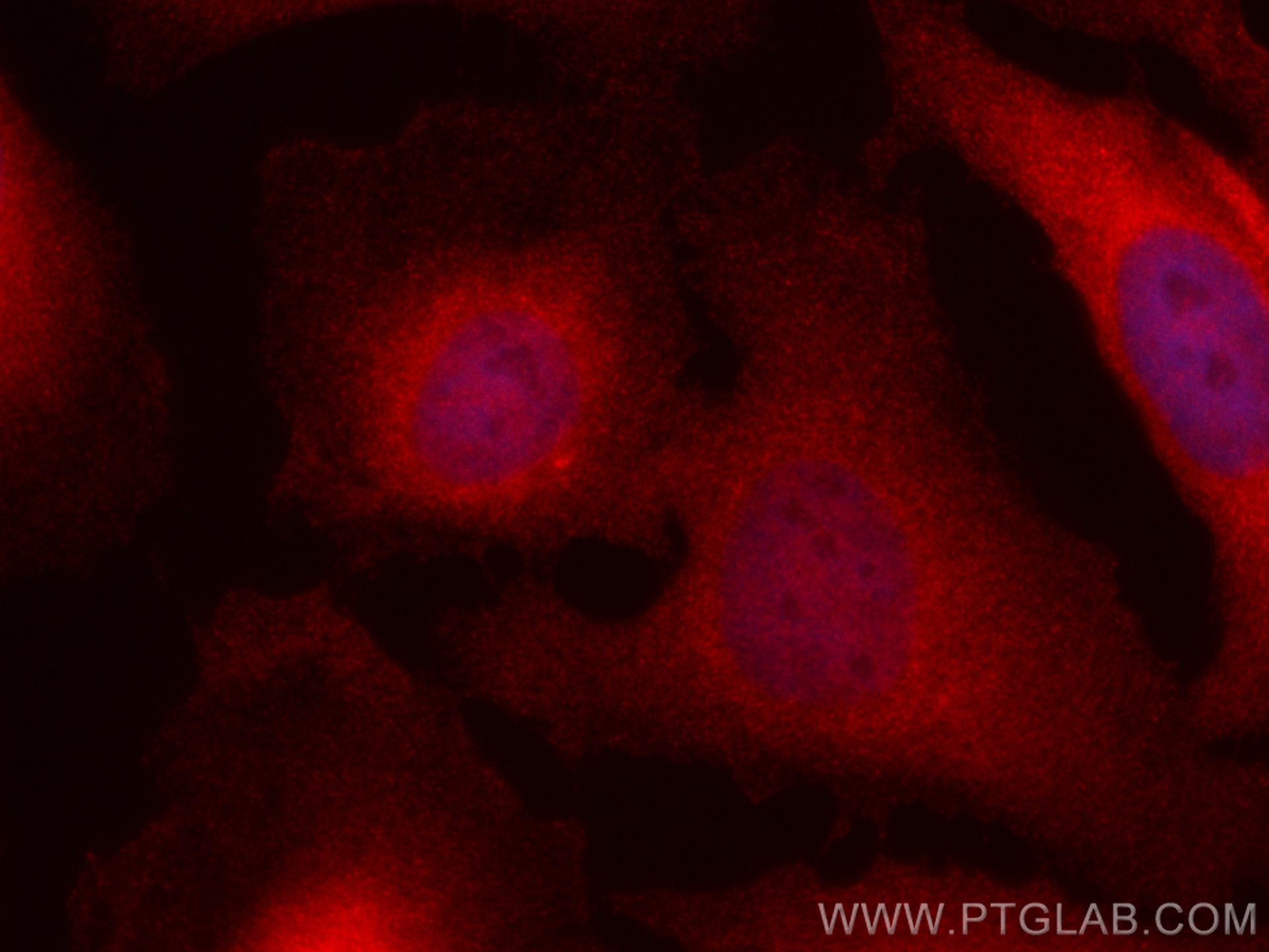 Immunofluorescence (IF) / fluorescent staining of HeLa cells using CoraLite®594-conjugated IKBKG Monoclonal antibody (CL594-66460)
