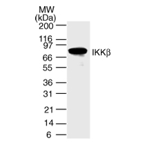 IKKb mAb (Clone 10AG2) tested by Western blot. IKKb detection by Western blot analysis. IKKb can be detected in 30 ug of Daudi whole-cell extract with IKKb mAb (Clone 10AG2) at a 1 ug/ml dilution.