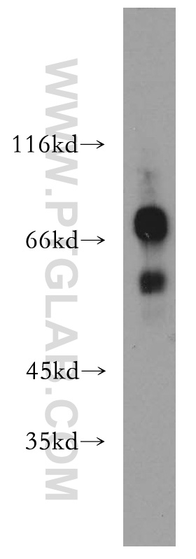 Western Blot (WB) analysis of Jurkat cells using IKZF3 Polyclonal antibody (13561-1-AP)